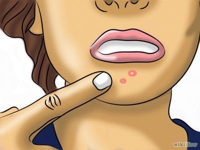 Проблемы кожи в период менопаузы thumbnail