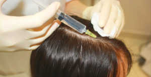 Озонотерапия для более быстрого роста волос
