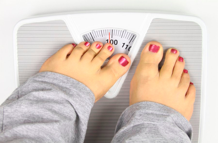 Избыточный вес - одна из причин вальгусной деформации