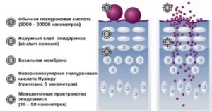 Схема гилауроновая кислота в организме