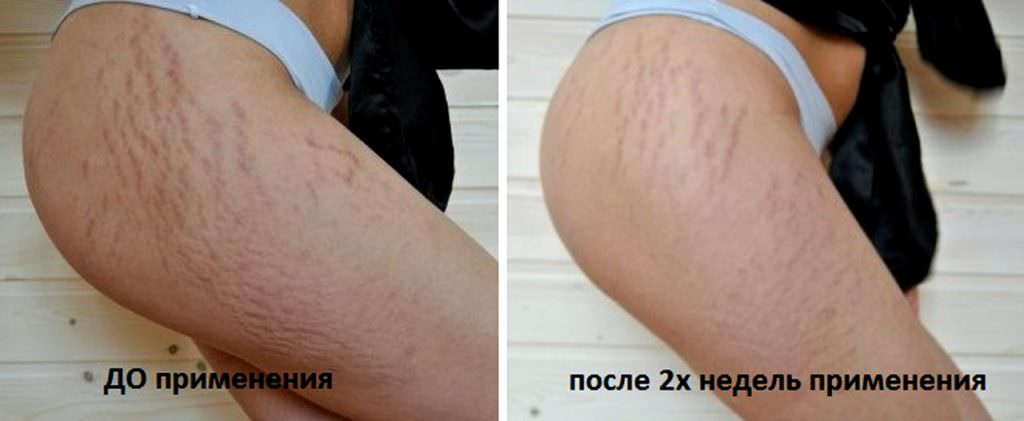 Фото до и после применения бадяги