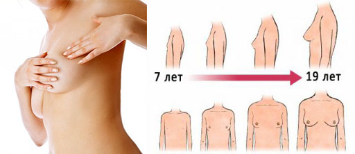 Схема роста груди от 7 до 19 лет