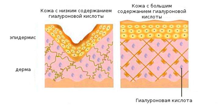Действие гиалуроновой кислоты на кожу