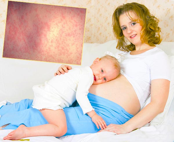 Период беременности и лактации, заболевания кожи