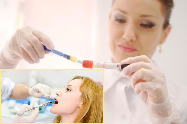 Лечение зубов плазмолифтингом