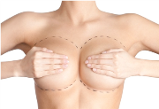 Пластическая операция по увеличению груди