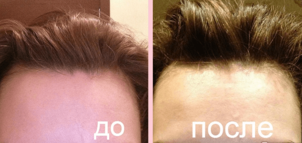Причёска до и после пилинга