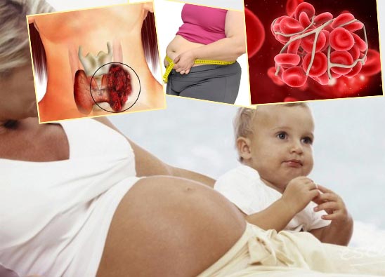Период беременности и лактации, лишний вес, болезни крови и щитовидки