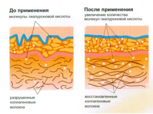 Строение кожи. Коллагеновые волокна