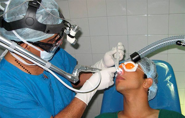 Операция по исправлению носовой перегородки лазером отзывы