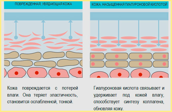 Схема воздействия гиалуроновой кислоты на кожу губ