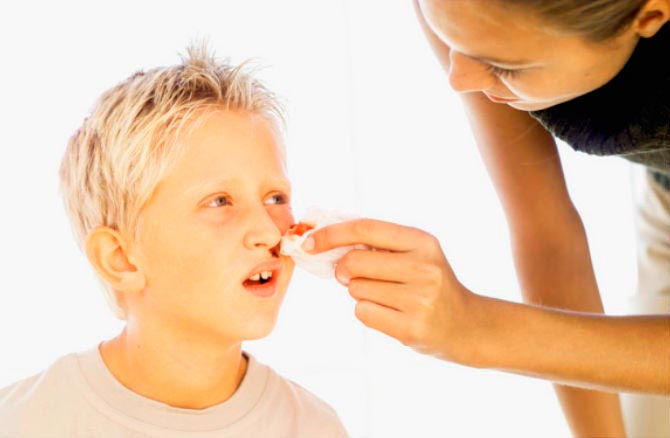 Кровотечения из носа у детей с искривленной носовой перегородкой