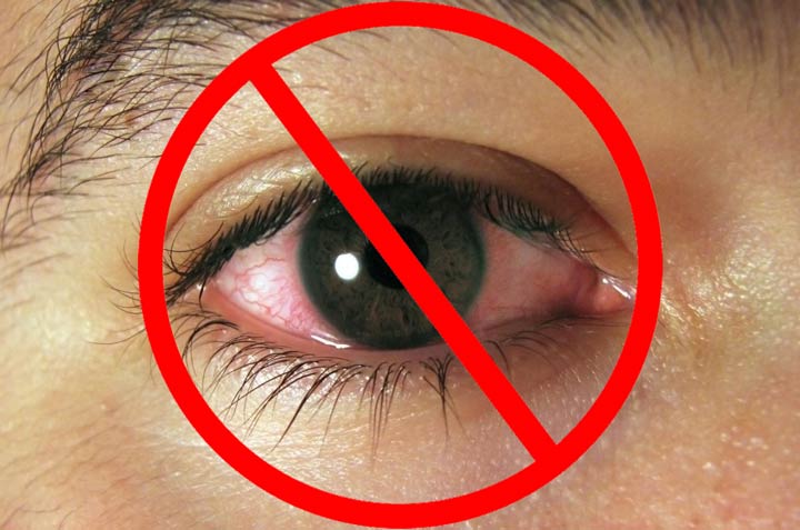 Воспалительное заболевание глаз