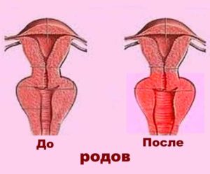 Как происходит растяжение вагины