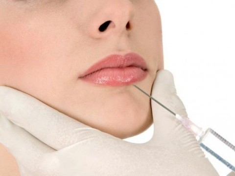 контурная пластика губ гиалуроновой кислотой